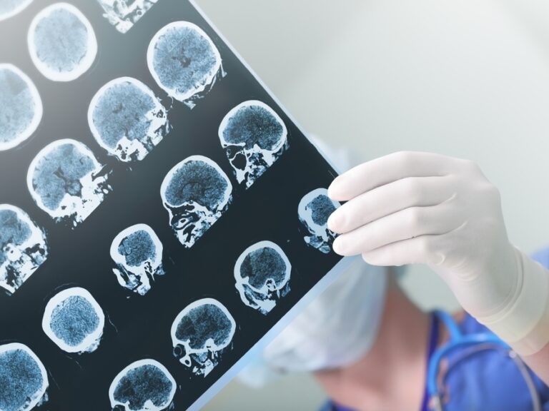 Startup Europa, 15 milioni per la spagnola Anaconda Biomed (di cui 3,4 da Innogest)